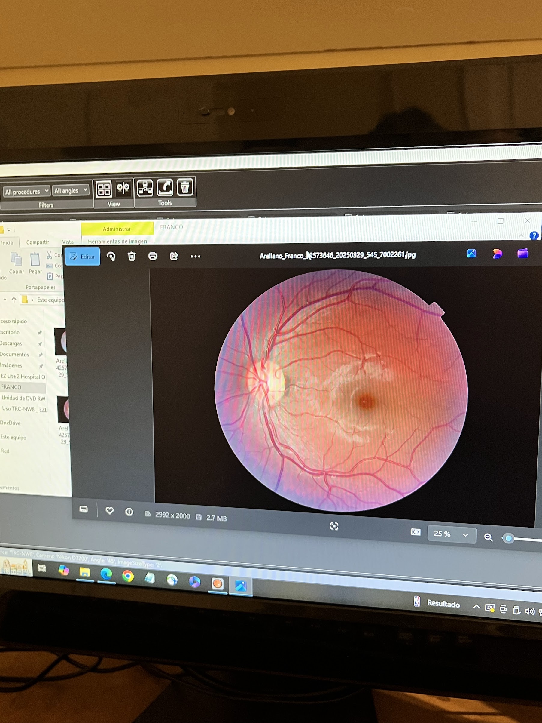 Estudio de retina en pantalla