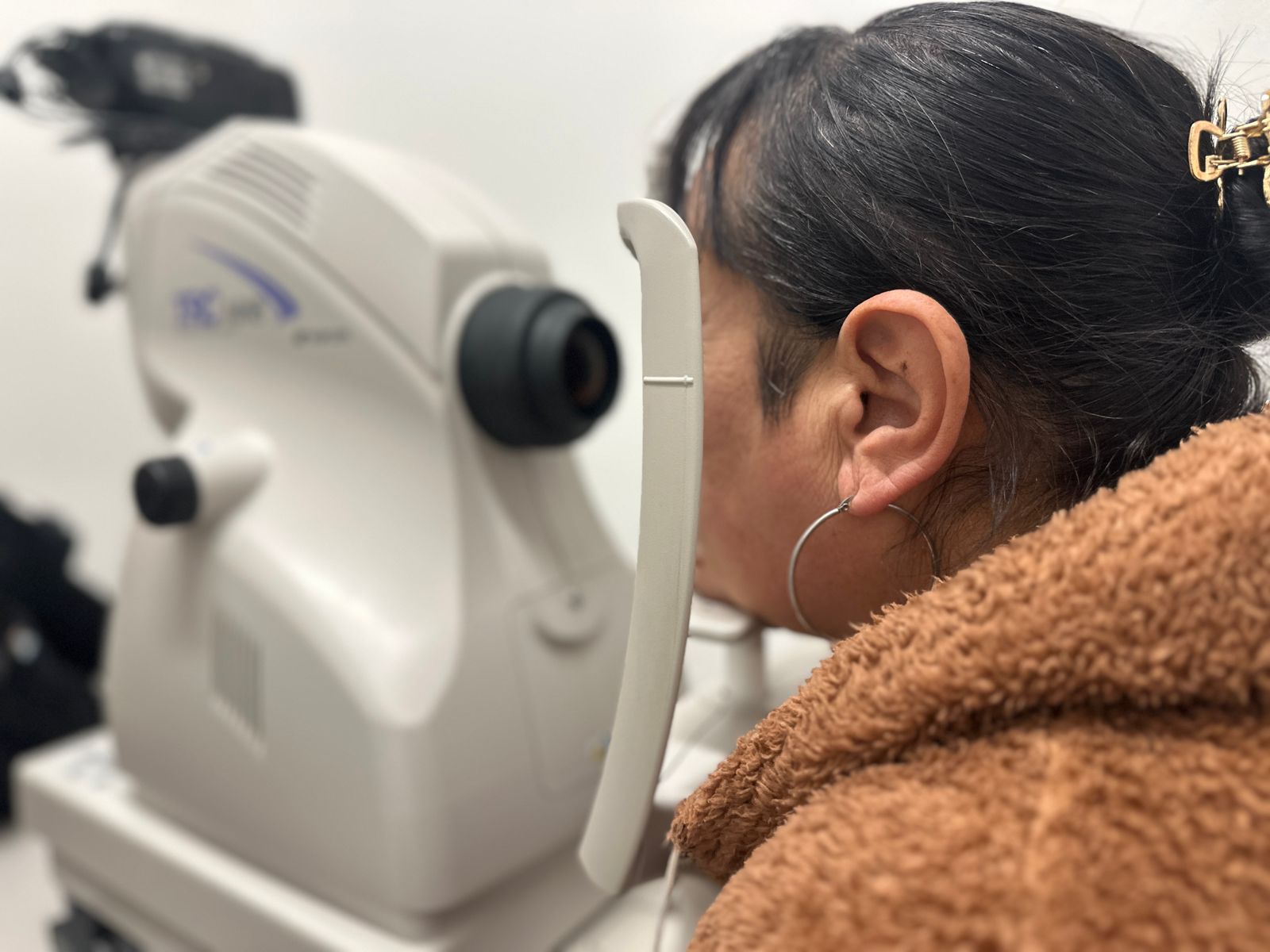 Paciente de espaldas apoyada en la mentonera del retinógrafo durante la captura