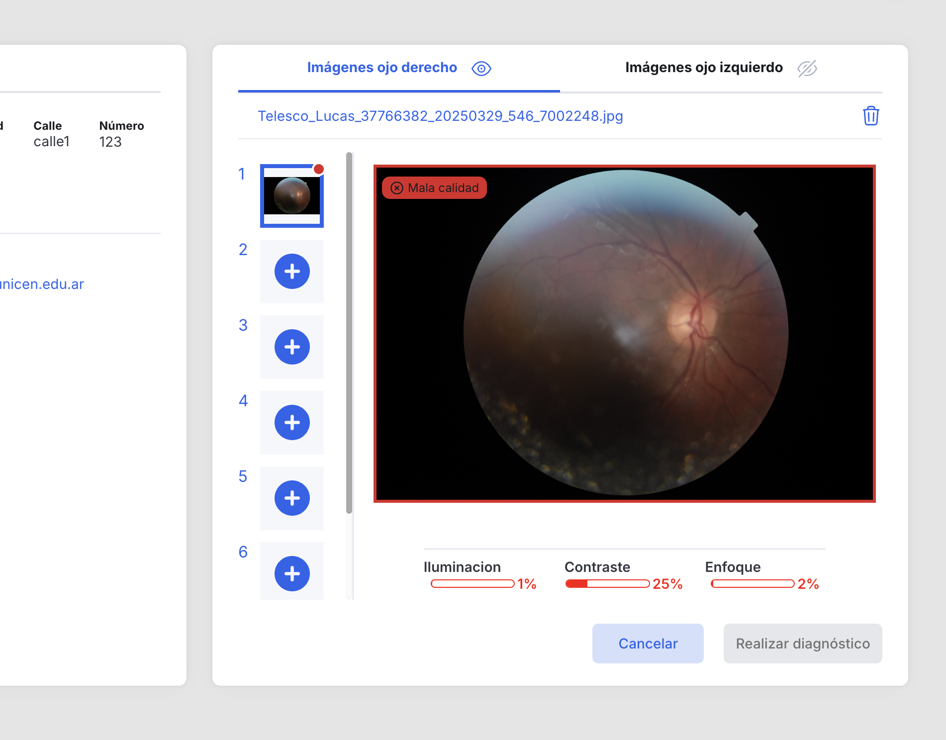 Control de calidad automático de la imagen
